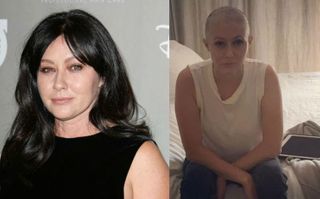 Фото: Шеннен Доэрти до и после химиотерапии, коллаж от pokatim.ru
